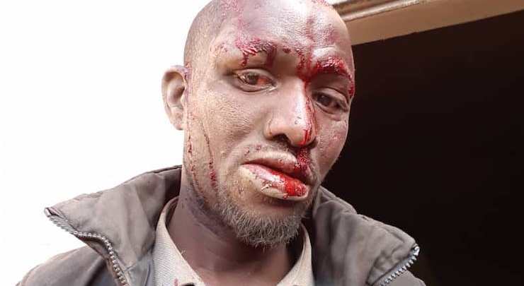 آثر التعذيب على "عبد" في جمهورية مالي